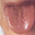 Diagnóstico por la lengua en la Medicina China Tradicional